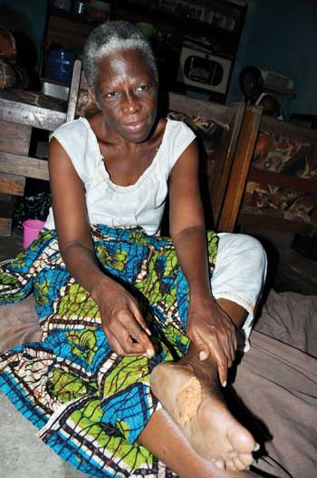 Amoin Koffi de Ma Famille : Elle échappe à la paralysie 