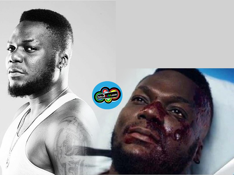 Que s’est-il passé pour que Mix 1er se retrouve dans un tel état?