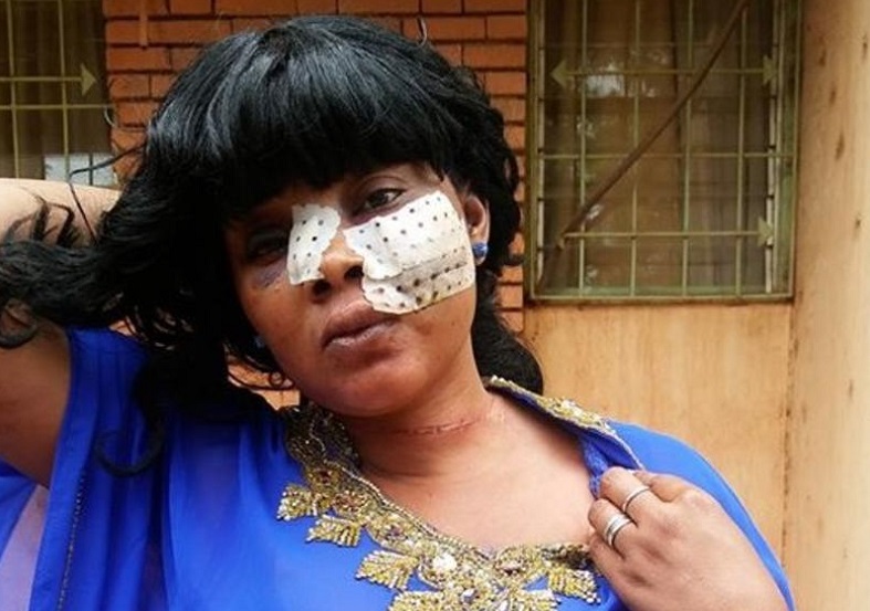 Accusé de vol de bébé l'artiste Adja Divine se fait lyncher par la foule