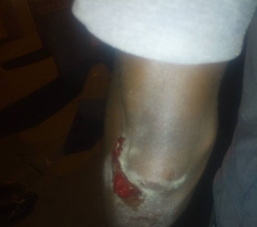 Abidjan : un jeune homme plonge d'un gbaka pour échapper à un enlèvement 